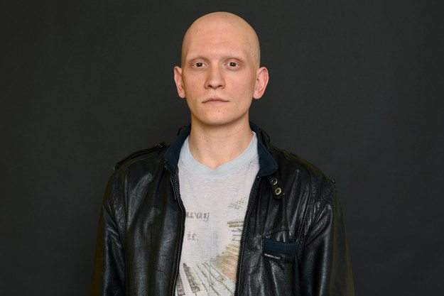 “Gotham’s” Anthony Carrigan Talks Acting, Alopecia, And Learning To Love His Look