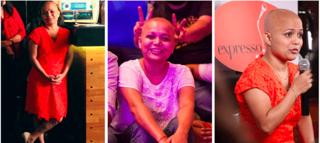 The Long, Brave Journey From Alopecia To Acceptance